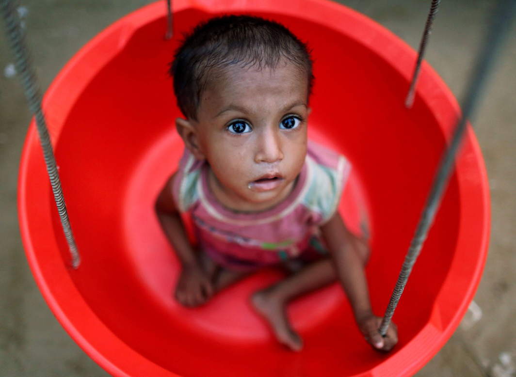 INHERITANCE OF LOSS: A Rohingya refugee girl is weighed at the emergency nutrition treatment centre in Balukhali refugee camp near Cox's Bazar, Bangladesh, Reuters/UNI