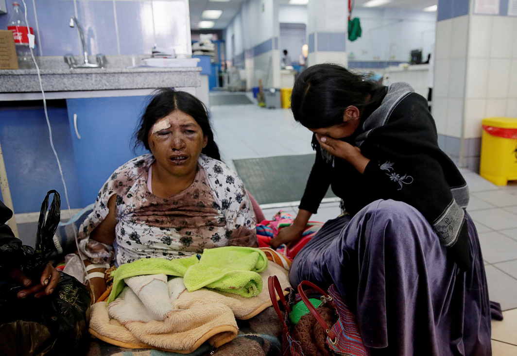 DESPAIR: A relative visits an injured woman at the emergency room of the general hospital during a strike by healthcare employees against Bolivia's government policies for health rules, in La Paz, Reuters/UNI