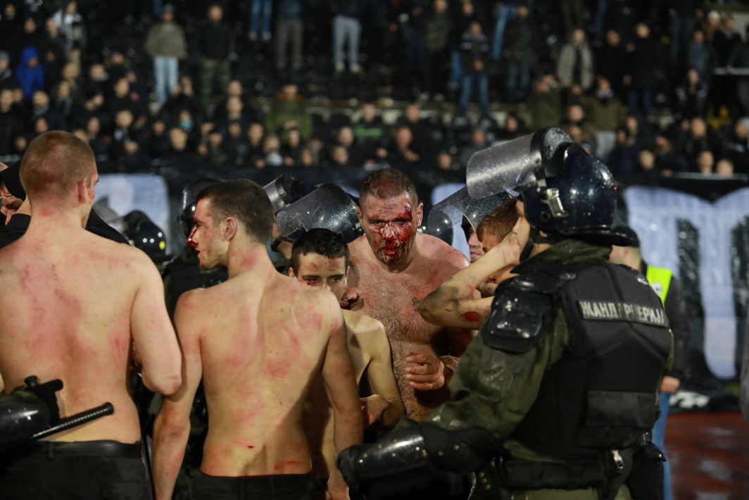 BARMY ARMIES: Police escort soccer fans injured during the fights at a match between Red Star and Partizan in Belgrade, Serbia, Reuters/UNI